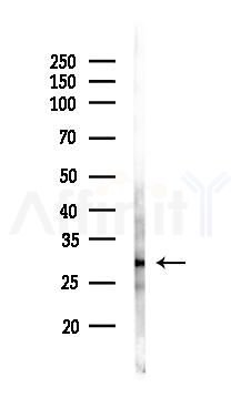 CSPS Antibody - Western blot analysis of lysates from Rat liver, using CSPS Antibody at 1/1000 dilution.
