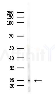 TMBIM6 Antibody - Western blot analysis of lysates from LoVo cells(heat-shock, 45min treatment), using TMBIM6 Antibody at 1/1000 dilution.