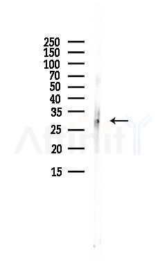 JMJD8 Antibody - Western blot analysis of lysates from Hela cells(UV, 30min treatment), using JMJD8 Antibody at 1/1000 dilution.