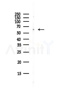 FOXJ2 Antibody - Western blot analysis of lysates from Hela cells(UV, 30min treatment), using FOXJ2 Antibody at 1/1000 dilution.