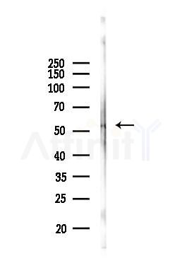 ZNF365 Antibody - Western blot analysis of lysates from Mouse liver, using ZNF365 Antibody at 1/1000 dilution.