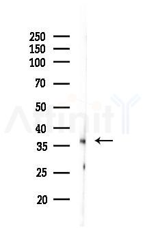 RAX Antibody - Western blot analysis of lysates from Rat liver, using RAX Antibody at 1/1000 dilution.