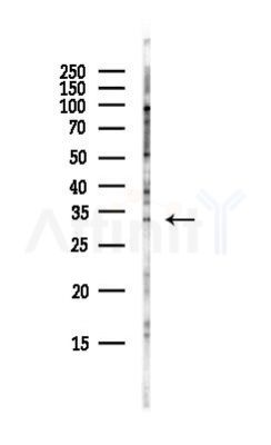 TSNAX Antibody - Western blot analysis of lysates from Hela cells(UV, 30min treatment), using TSNAX Antibody at 1/1000 dilution.
