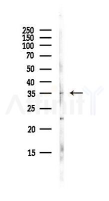 ZFPL1 Antibody - Western blot analysis of lysates from Hela cells(UV, 30min treatment), using ZFPL1 Antibody at 1/1000 dilution.