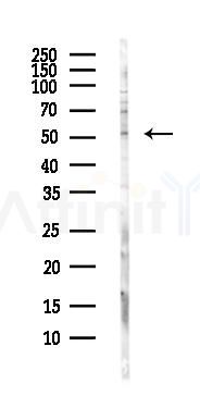 PPP2R2C Antibody - Western blot analysis of lysates from Hela cells(heat-shock,45min treatment), using PPP2R2C Antibody at 1/1000 dilution.