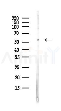 GLIS2 Antibody - Western blot analysis of lysates from Hela cells(heat-shock,45min treatment), using GLIS2 Antibody at 1/1000 dilution.
