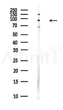 ZNF341 Antibody - Western blot analysis of lysates from Hela cells(heat-shock,45min treatment), using ZNF341 Antibody at 1/1000 dilution.