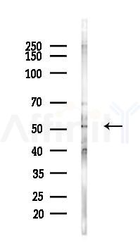 INSM1 Antibody - Western blot analysis of lysates from Hela cells(LPS,4h treatment), using INSM1 Antibody at 1/1000 dilution.