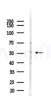 INSM1 Antibody - Western blot analysis of lysates from LoVo cells(heat-shock,45min treatment), using INSM1 Antibody at 1/1000 dilution.