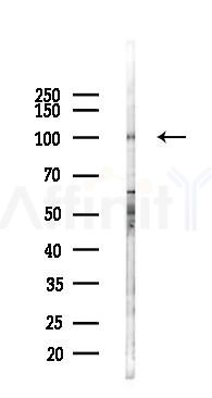 KIF2A Antibody - Western blot analysis of lysates from LoVo cells(heat-shock,45min treatment), using KIF2A Antibody at 1/1000 dilution.
