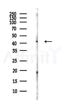 NME7 Antibody - Western blot analysis of lysates from Hela cells(heat-shock,45min treatment), using NME7 Antibody at 1/1000 dilution.