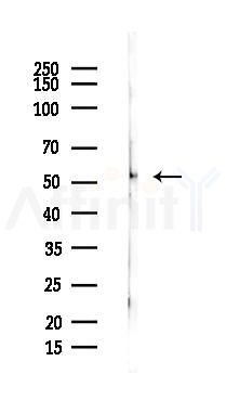 PI4K2B Antibody - Western blot analysis of lysates from PC12 cells, using PI4K2B Antibody at 1/1000 dilution.
