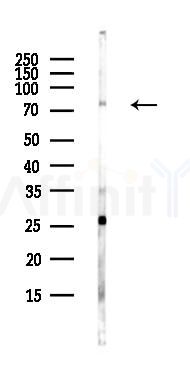 MTMR8 Antibody - Western blot analysis of lysates from Hela cells(heat-shock,45min treatment), using MTMR8 Antibody at 1/1000 dilution.