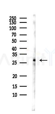 RCAN3 Antibody - Western blot analysis of lysates from MC-3T3-E1 cells, using RCAN3 Antibody at 1/1000 dilution.