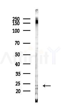 GUCA1C Antibody - Western blot analysis of lysates from Hela cells(LPS,4h treatment), using GUCA1C Antibody at 1/1000 dilution.