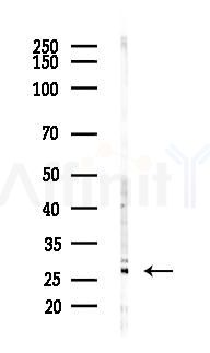 MPDU1 Antibody - Western blot analysis of lysates from Hela cells(LPS,4h treatment), using MPDU1 Antibody at 1/1000 dilution.
