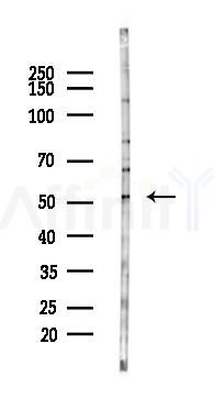 ZBTB43 Antibody - Western blot analysis of lysates from Hela cells(LPS,4h treatment), using ZBTB43 Antibody at 1/1000 dilution.