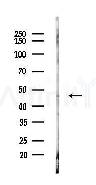 IKZF5 Antibody - Western blot analysis of lysates from LoVo cells(heat-shock,45min treatment), using IKZF5 Antibody at 1/1000 dilution.