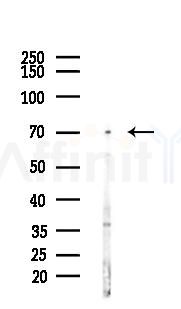 SPPL2B Antibody - Western blot analysis of lysates from LoVo cells(heat-shock,45min treatment), using SPPL2B Antibody at 1/1000 dilution.