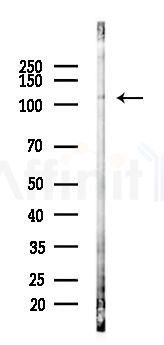 CAPN15 Antibody - Western blot analysis of lysates from Hela cells(LPS,4h treatment), using CAPN15 Antibody at 1/1000 dilution.