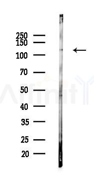 CAPN15 Antibody - Western blot analysis of lysates from LoVo cells(heat-shock,45min treatment), using CAPN15 Antibody at 1/1000 dilution.