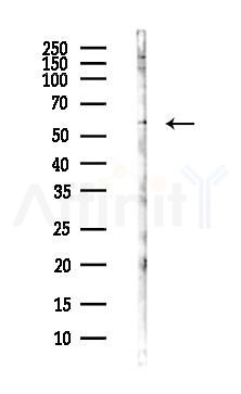 PRIM2 Antibody - Western blot analysis of lysates from Hela cells(heat-shock,45min treatment), using PRIM2 Antibody at 1/1000 dilution.