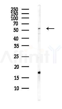 TUB Antibody - Western blot analysis of lysates from Hela cells(heat-shock,45min treatment), using TUB Antibody at 1/1000 dilution.
