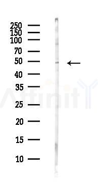 ZP3 Antibody - Western blot analysis of lysates from Hela cells(heat-shock,45min treatment), using ZP3 Antibody at 1/1000 dilution.