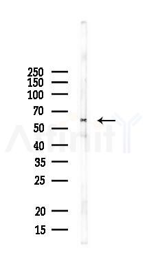 CHRNE Antibody - Western blot analysis of lysates from Mouse brain, using CHRNE Antibody at 1/1000 dilution.