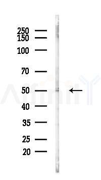 NOVA2 Antibody - Western blot analysis of lysates from Hela cells(LPS,4h treatment), using NOVA2 Antibody at 1/1000 dilution.