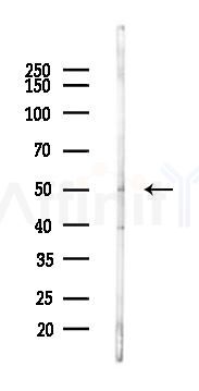 NOVA2 Antibody - Western blot analysis of lysates from LoVo cells(heat-shock,45min treatment), using NOVA2 Antibody at 1/1000 dilution.