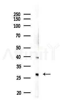 TLX2 Antibody - Western blot analysis of lysates from COLO205 cells, using TLX2 Antibody at 1/1000 dilution.