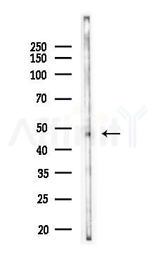 KYAT3 Antibody - Western blot analysis of lysates from COLO205 cells, using KYAT3 Antibody at 1/1000 dilution.