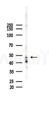 TMEM5 Antibody - Western blot analysis of lysates from COLO205 cells(heat-shock,45min treatment), using TMEM5 Antibody at 1/1000 dilution.