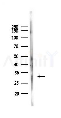 LY6G6F Antibody - Western blot analysis of lysates from Rat liver, using LY6G6F Antibody at 1/1000 dilution.