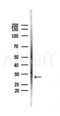 LY6G6F Antibody - Western blot analysis of lysates from COLO205 cells(heat-shock,45min treatment), using LY6G6F Antibody at 1/1000 dilution.