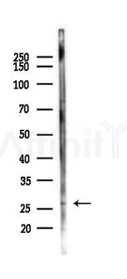 UBTD1 Antibody - Western blot analysis of lysates from Mouse testis, using UBTD1 Antibody at 1/1000 dilution.