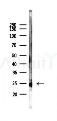 UBTD1 Antibody - Western blot analysis of lysates from Rat liver, using UBTD1 Antibody at 1/1000 dilution.