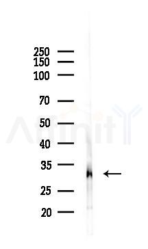 LDLRAP1 Antibody - Western blot analysis of lysates from PC12 cells, using LDLRAP1 Antibody at 1/1000 dilution.