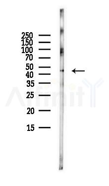 TASP1 Antibody - Western blot analysis of lysates from LoVo cells(heat-shock,45min treatment), using TASP1 Antibody at 1/1000 dilution.