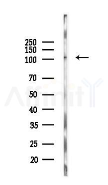 CARD14 Antibody - Western blot analysis of lysates from PC12 cells, using CARD14 Antibody at 1/1000 dilution.