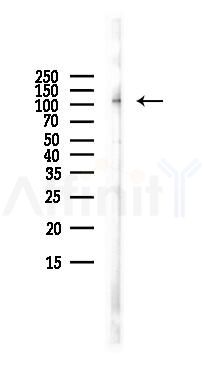CARD14 Antibody - Western blot analysis of lysates from LoVo cells(heat-shock,45min treatment), using CARD14 Antibody at 1/1000 dilution.