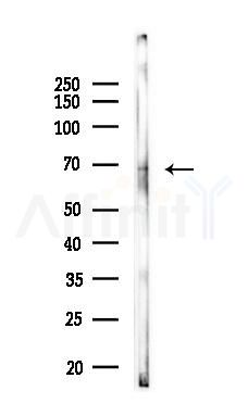 RPN2 Antibody - Western blot analysis of lysates from COLO205 cells, using RPN2 Antibody at 1/1000 dilution.