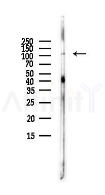 MAML1 Antibody - Western blot analysis of lysates from LoVo cells(heat-shock,45min treatment), using MAML1 Antibody at 1/1000 dilution.