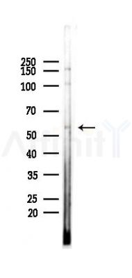 NAGS Antibody - Western blot analysis of lysates from COLO205 cells(heat-shock,45min treatment), using NAGS Antibody at 1/1000 dilution.