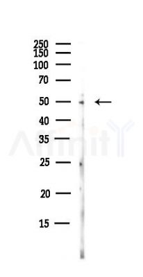 HTRA4 Antibody - Western blot analysis of lysates from HUVEC cells(UV,30min treatment), using HTRA4 Antibody at 1/1000 dilution.