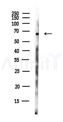 UBXN4 Antibody - Western blot analysis of lysates from HUVEC cells(UV,30min treatment), using UBXN4 Antibody at 1/1000 dilution.