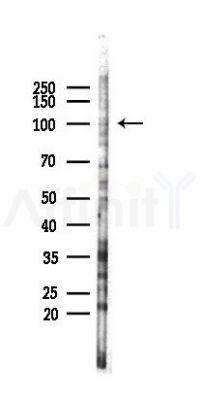 ADAM22 Antibody - Western blot analysis of lysates from COLO205 cells(heat-shock,45min treatment), using ADAM22 Antibody at 1/1000 dilution.