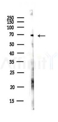 USP2 Antibody - Western blot analysis of lysates from HUVEC cells(UV,30min treatment), using USP2 Antibody at 1/1000 dilution.