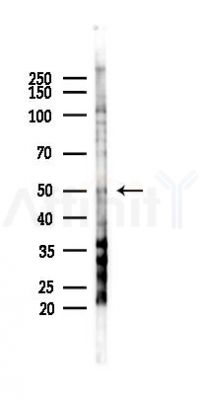 KCNAB3 Antibody - Western blot analysis of lysates from COLO205 cells(heat-shock,45min treatment), using KCNAB3 Antibody at 1/1000 dilution.